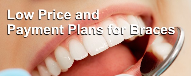Get short-term braces in Issaquah and Sammamish